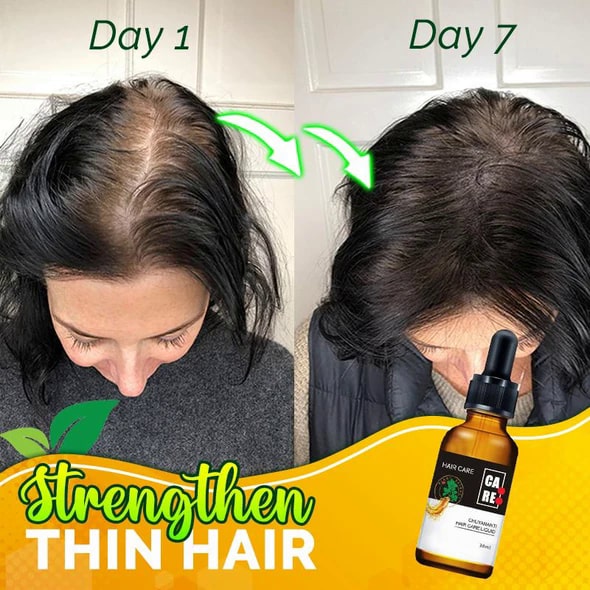 סרום שיער חזק 10X-Regro