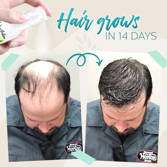 ספריי ג'ינג'ר אקטיבי לשיער שורש בוסט – תמונה 2