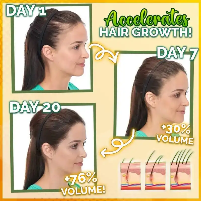 סרום שיער חזק 10X-Regro – תמונה 2