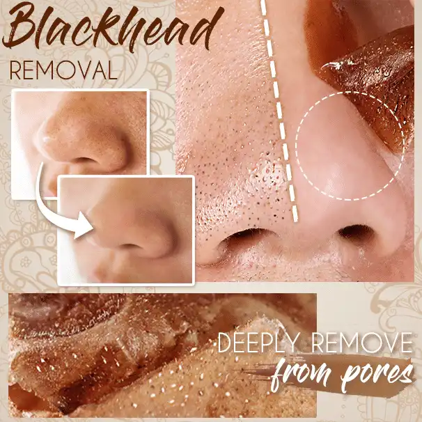 Maskiss Herbal Peel Off מסכת – תמונה 2