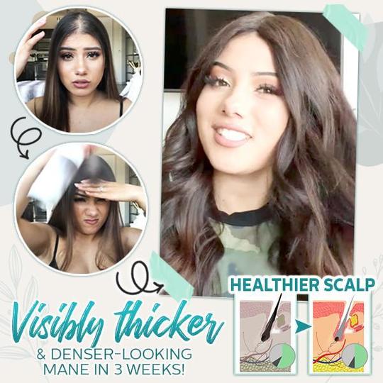 ספריי ג'ינג'ר אקטיבי לשיער שורש בוסט – תמונה 4