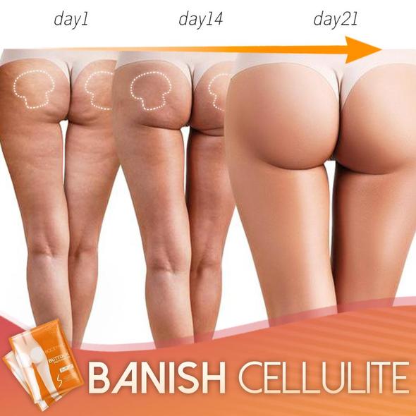 סט תיקון לעיצוב תחת-הרמת פרו – תמונה 4