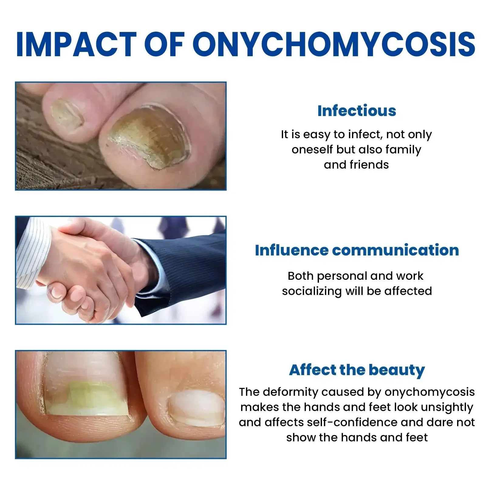 מדבקות לתיקון ציפורניים פטריות – תמונה 2