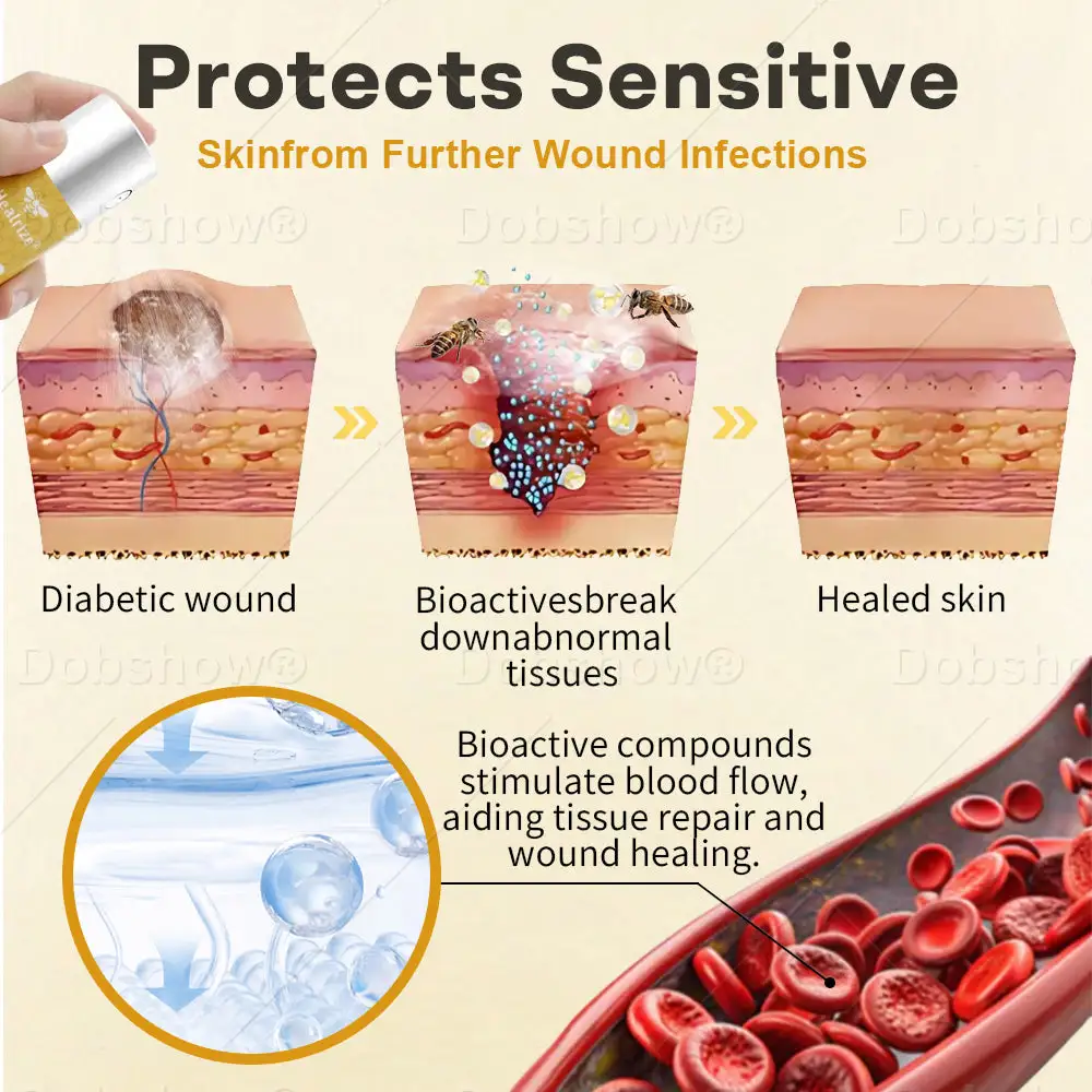 תרסיס ארס פצעים של GlucoShield Bee – תמונה 3