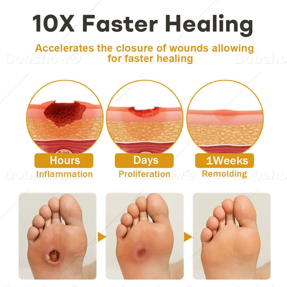 תרסיס ארס פצעים של GlucoShield Bee – תמונה 4