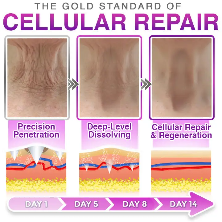 תיקון אנטי אייג'ינג 3 ב-1 Microneedle – תמונה 3