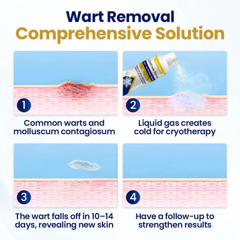 ChillErase Bump & תרסיס לחידוש תג עור – תמונה 4