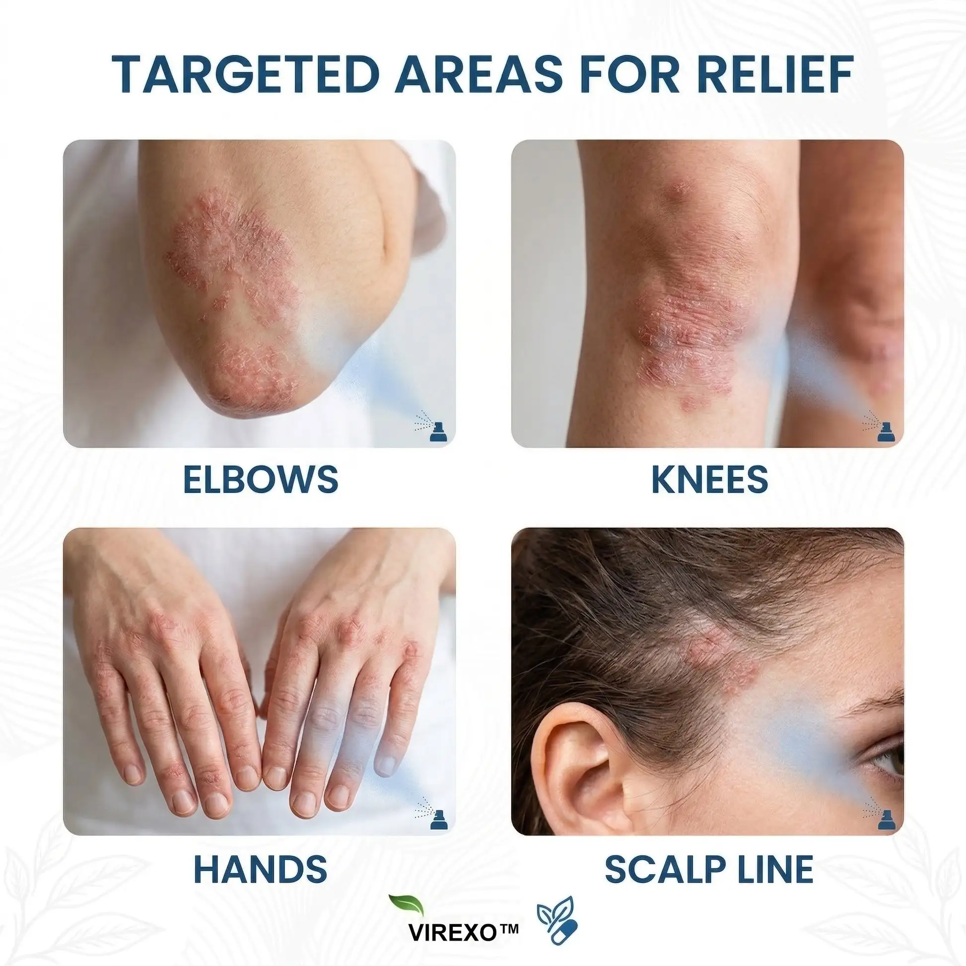 ספריי בוטני מגנזיום – תמונה 2