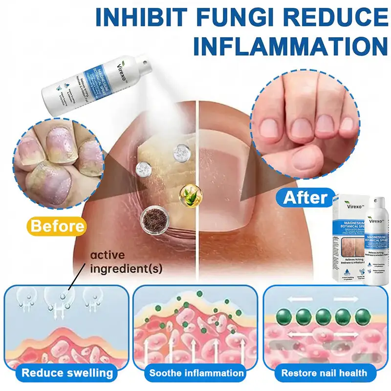 ספריי בוטני מגנזיום – תמונה 4