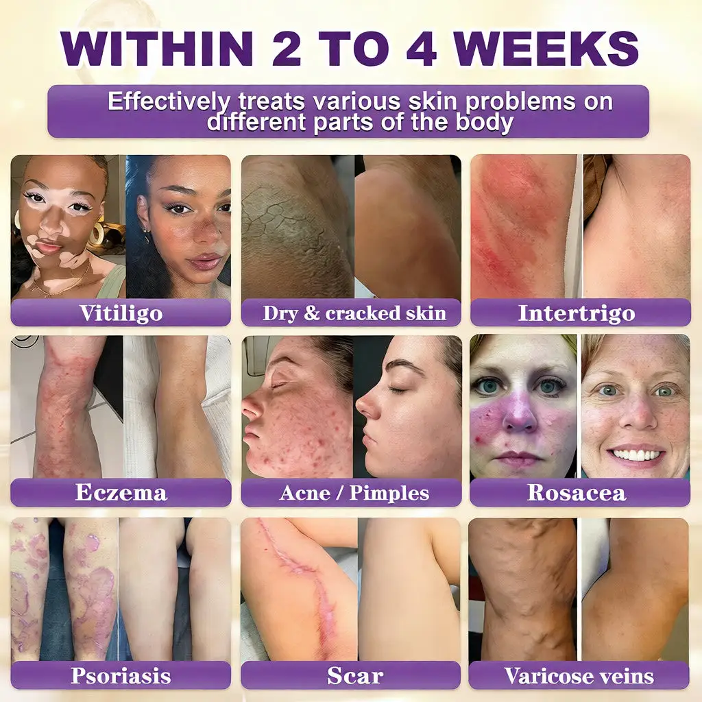 קרם לשיקום עור ביוטין 10 ב-1 – תמונה 2