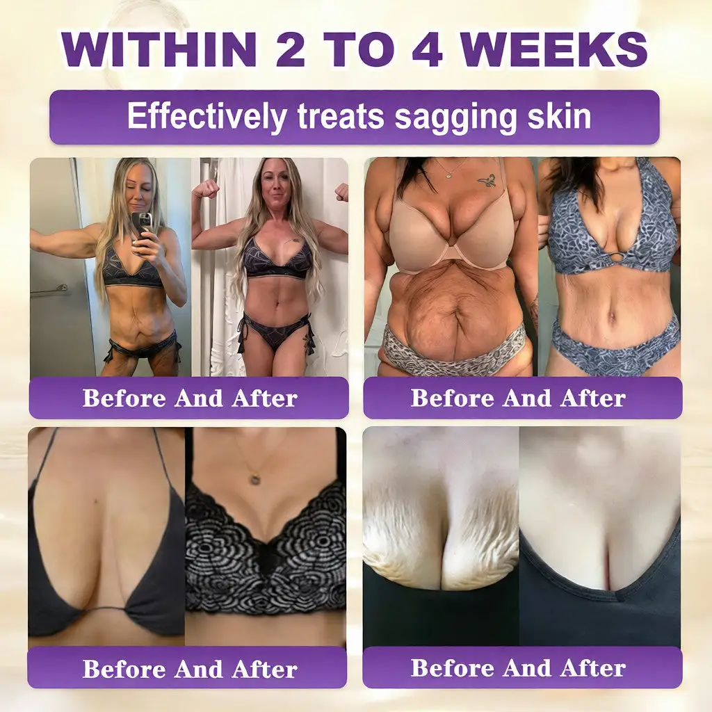 קרם לשיקום עור ביוטין 10 ב-1 – תמונה 3