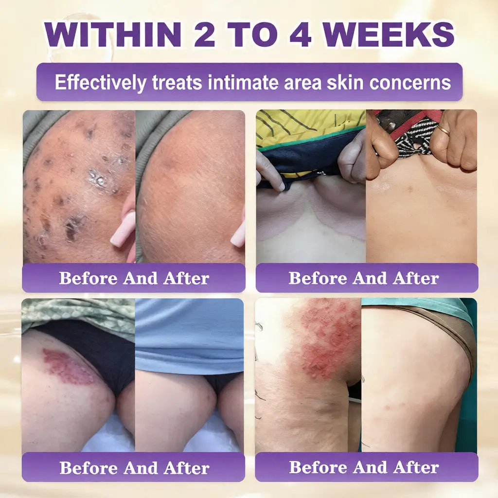 קרם לשיקום עור ביוטין 10 ב-1 – תמונה 4