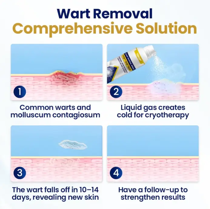 ספריי לחידוש בליטות של צ'יליק – תמונה 3